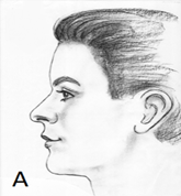 normal-face-a