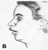 opened-mouth-posture-b